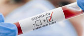 País: Mais 21 casos da Covid-19, elevando cumulativo para 1.557 infectados