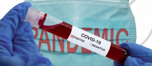 País: Mais 50 novos casos da Covid-19 elevam cumulativo para 2.079