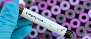 País: Mais 59 casos da Covid-19 elevam cumulativo para 2.914 infectados